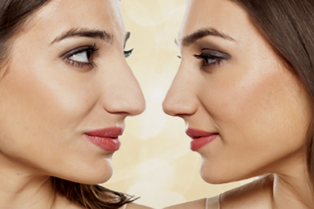 nose-reshaping