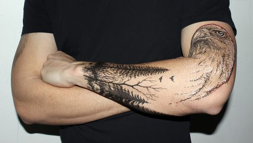 tattoo removal